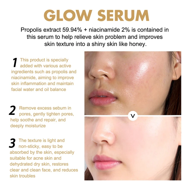 Alt view image 3 of 6 - Propolis Niacinamide Lightweight Essence for Brightening Skin and Reducing Acne Scars