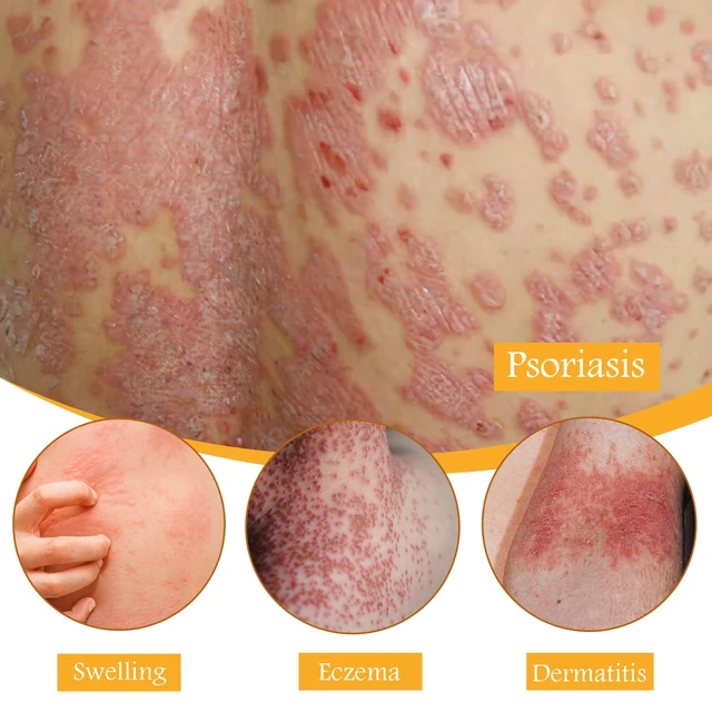Alt view image 4 of 6 - Moss Repair Cream for Itching Relief & Redness Reduction