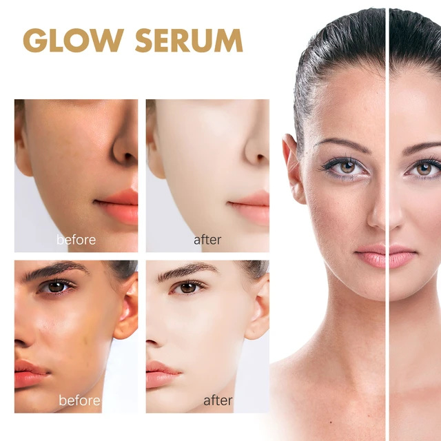 Alt view image 4 of 6 - Propolis Niacinamide Lightweight Essence for Brightening Skin and Reducing Acne Scars