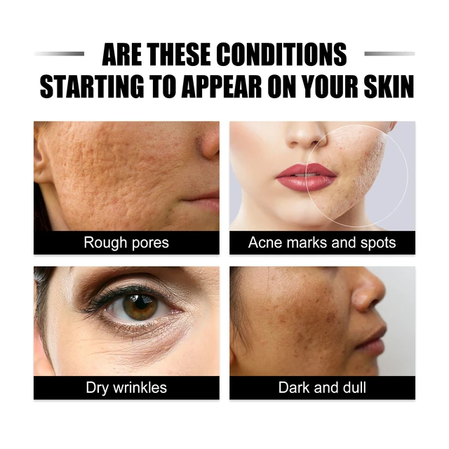 Alt view image 3 of 6 - Hydrated & Moisturized Skin Tone Enhancement, Ginseng Snail Serum for Radiant
