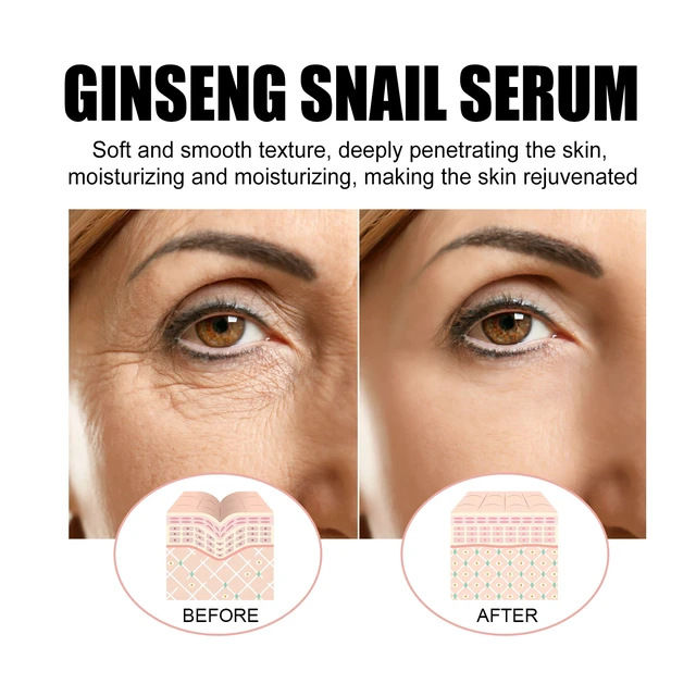 Alt view image 4 of 6 - Hydrated & Moisturized Skin Tone Enhancement, Ginseng Snail Serum for Radiant