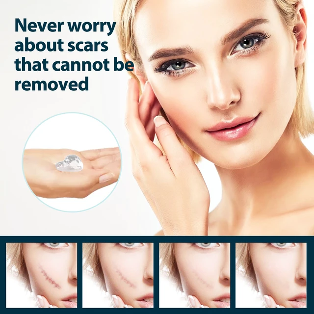 Alt view image 4 of 5 - Gentle Body Skin Repair Gel for Smooth Moisturizing & Bump Care