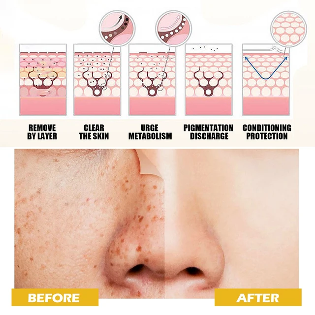 Alt view image 4 of 6 - Soothing & Pore Minimizing Essence for Smooth Skin, Turmeric Facial Toner - Hydrating