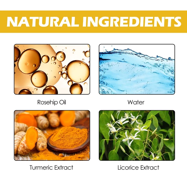 Alt view image 5 of 6 - Soothing & Pore Minimizing Essence for Smooth Skin, Turmeric Facial Toner - Hydrating