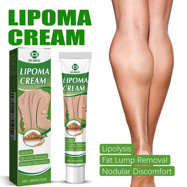 Alt view image 2 of 6 - Fat Knot Dissolving Cream - Body Care for Subcutaneous Lumps & Fatty Tumors