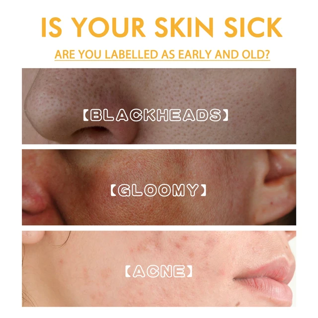 Alt view image 3 of 7 - Hydrating & Moisturizing for Dull Skin Revitalization, Radiant Tear Mask - Gentle Deep Cleansing