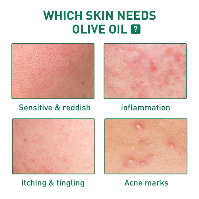 Alt view image 3 of 6 - Tea Tree Oil Face Serum Hydrating Nourishing Moisturizing Skin Care Essence