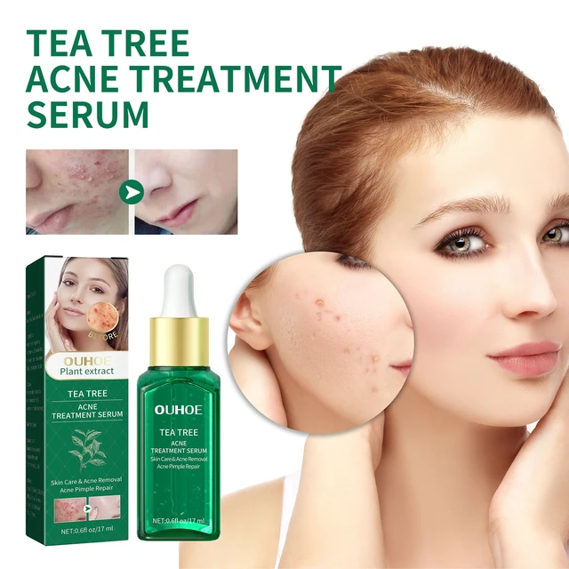Alt view image 2 of 6 - Tea Tree Oil Face Serum Hydrating Nourishing Moisturizing Skin Care Essence
