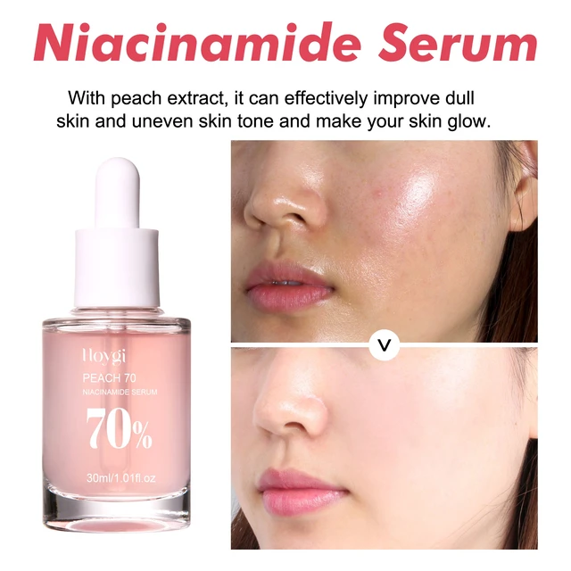 Alt view image 3 of 5 - Anti-Wrinkle & Brightening, Acne Scar Fading, Pore Minimization, Hydration, Niacinamide Serum for Skin Firming
