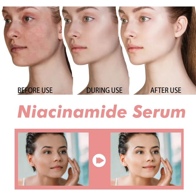 Alt view image 4 of 5 - Anti-Wrinkle & Brightening, Acne Scar Fading, Pore Minimization, Hydration, Niacinamide Serum for Skin Firming