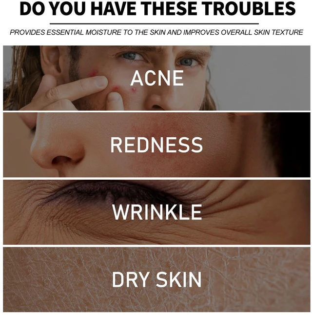 Alt view image 3 of 6 - Men's Multi-Action Cream Hydrating Cleansing Pore Minimizing Acne Treatment Smoothing Skin