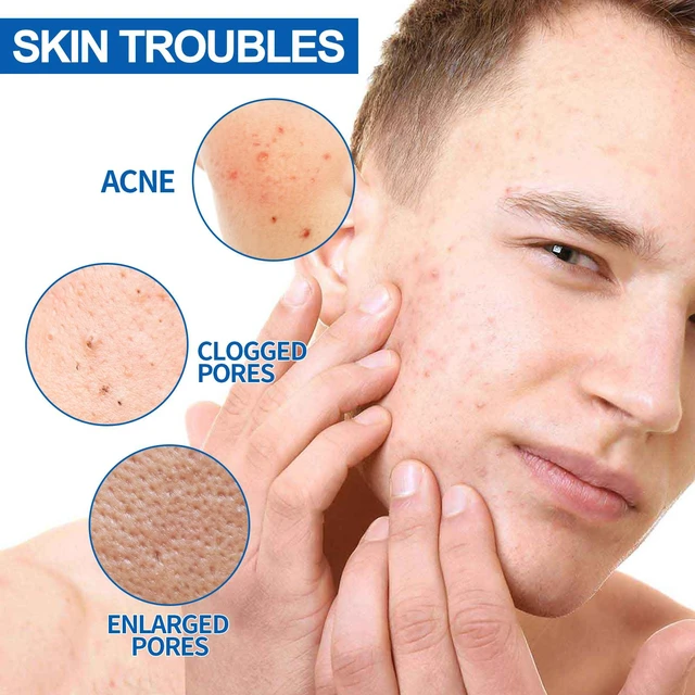 Alt view image 4 of 6 - Men's Multi-Action Cream Hydrating Cleansing Pore Minimizing Acne Treatment Smoothing Skin