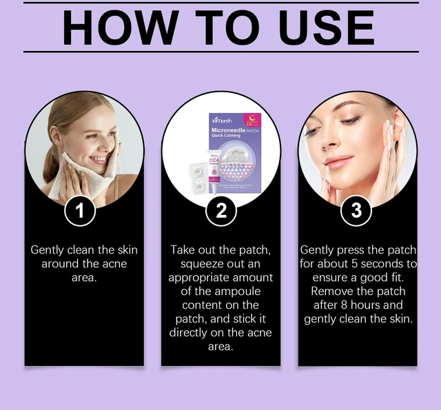 Alt view image 6 of 6 - Gentle Acne Care Patches Set for Daily Skin Moisturizing and Nourishing Facial Treatment