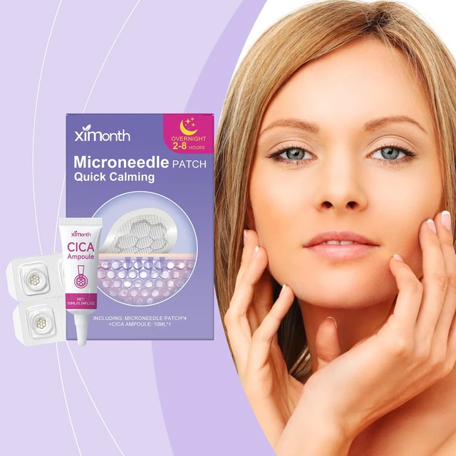 Alt view image 2 of 6 - Gentle Acne Care Patches Set for Daily Skin Moisturizing and Nourishing Facial Treatment