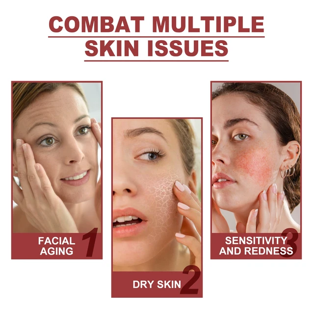 Alt view image 3 of 6 - Gentle Moisturizing Collagen Facial & Eye Mask Set for Skin Nourishment