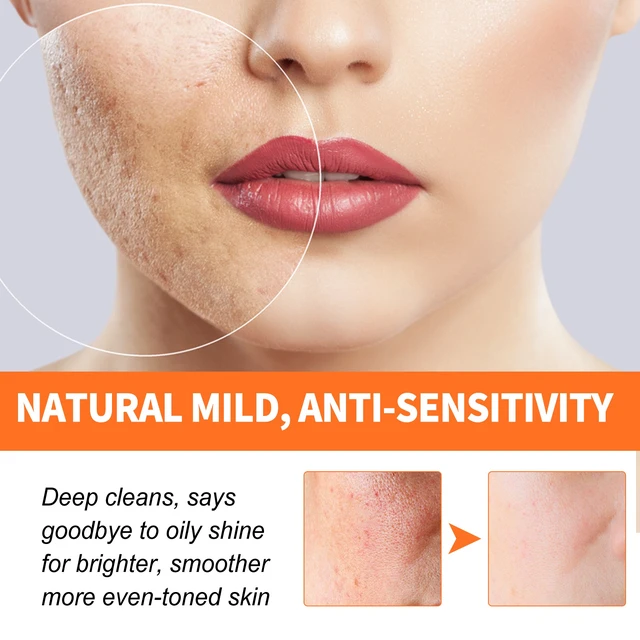 Alt view image 3 of 6 - Carrot Bubble Facial Mask Deep Cleansing Blackhead Removal Pore Tightening Skin Brightening