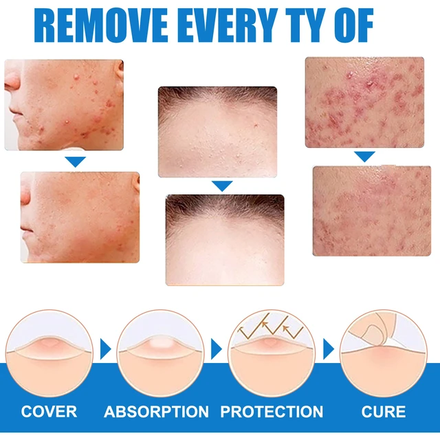 Alt view image 4 of 7 - Four-Leaf Clover Skin Repair Cream Granules for Body Care External Use