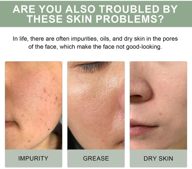 Alt view image 3 of 6 - Hydrating & Pore Refining, Deep Cleansing Facial Wash for Brightening