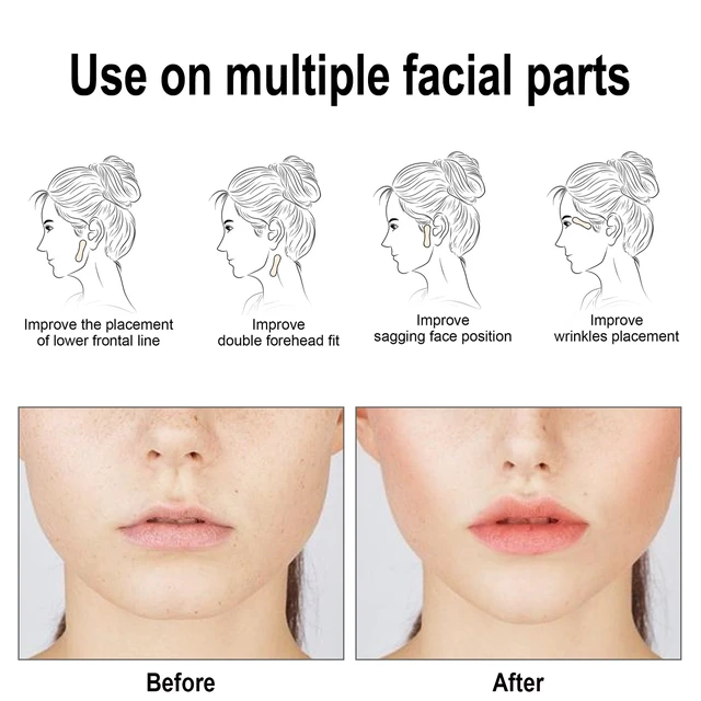 Alt view image 6 of 7 - Double Chin Corrector & Cheek Lifting Stickers for Slimming Effect, Invisible V-Line Face Lift Tape