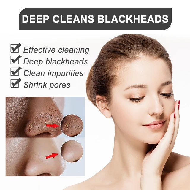 Alt view image 4 of 6 - Deep Pore Cleansing & Acne Removal for Skin Renewal and Pore Minimization, Peel-Off Blackhead Mask