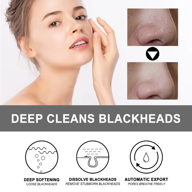 Alt view image 3 of 6 - Deep Pore Cleansing & Acne Removal for Skin Renewal and Pore Minimization, Peel-Off Blackhead Mask