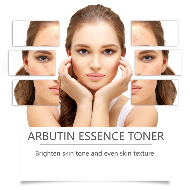 Alt view image 3 of 5 - Refreshing & Non-Greasy Moisturizing Soothing Facial Toner, Arbutin Toner - Gentle Nourishing