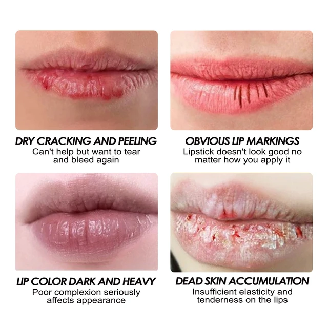 Alt view image 2 of 5 - Hydrating Lip Balm Anti-Dryness Exfoliating Doodle Design Moisturizing Care