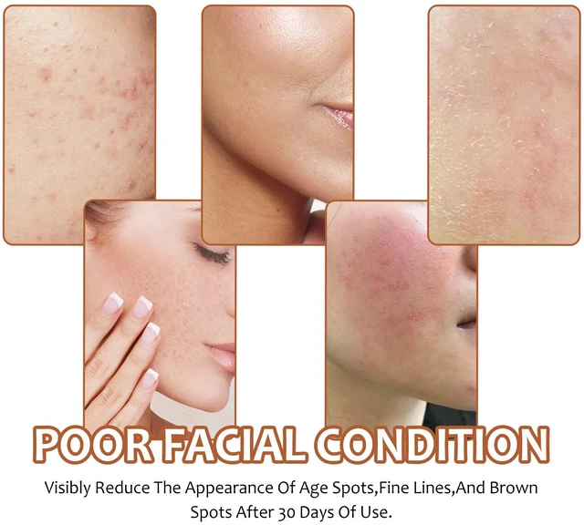 Alt view image 3 of 6 - Exfoliation & Moisturizing Face and Body Wash, Whitening, Skin Brightening, Kojic Acid Turmeric Lemon Soap for Deep Clean