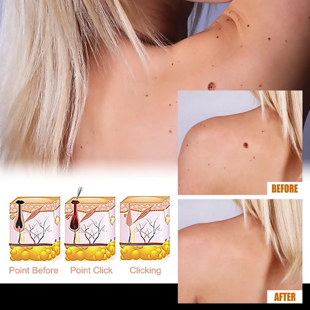 Alt view image 3 of 6 - Gentle Facial & Neck Cleansing Essence for Smooth Skin Care