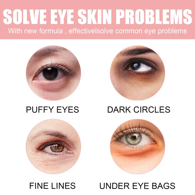 Alt view image 3 of 5 - Pink Rose Eye Patch Reduce Fine Lines Puffiness Dark Circles Hydrating Firming Skincare Eye Mask