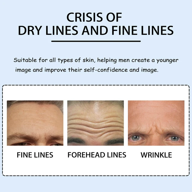 Alt view image 4 of 6 - Men's Forehead Wrinkle Removal Patches for Reducing Fine Lines