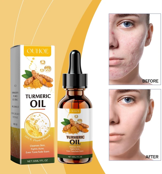 Main image of Ginger Butter Cleansing Oil Gentle Face Wash Moisturizing Brightening Refreshing Skin Care