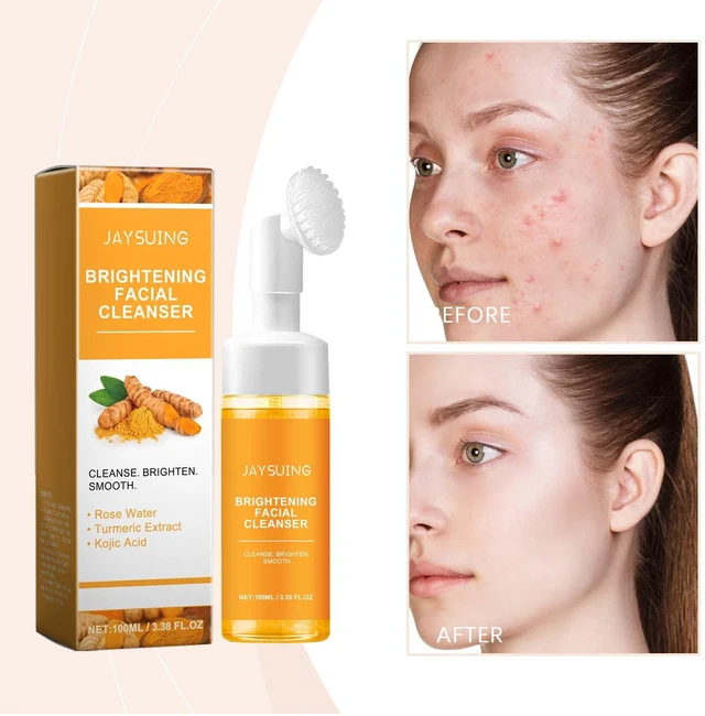 Main image of Hydrates & Moisturizes Skin Without Tightness, Turmeric Deep Cleansing Face Wash - Removes Excess Oil