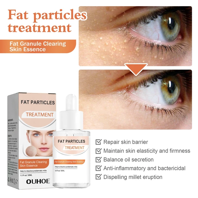 Alt view image 4 of 6 - Moisturizing & Pore Refining, Millet Care Essence for Acne Relief