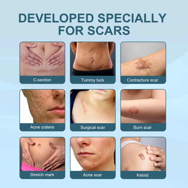 Alt view image 3 of 6 - West & Month Scar Care Gel - Moisturizing & Smoothing Skin Repair Formula