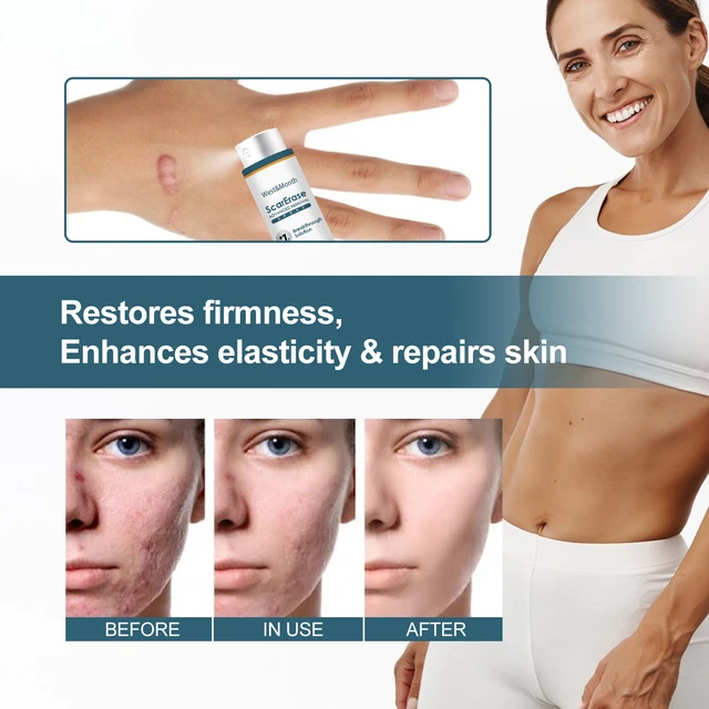 Alt view image 4 of 6 - West & Month Scar Care Gel - Moisturizing & Smoothing Skin Repair Formula