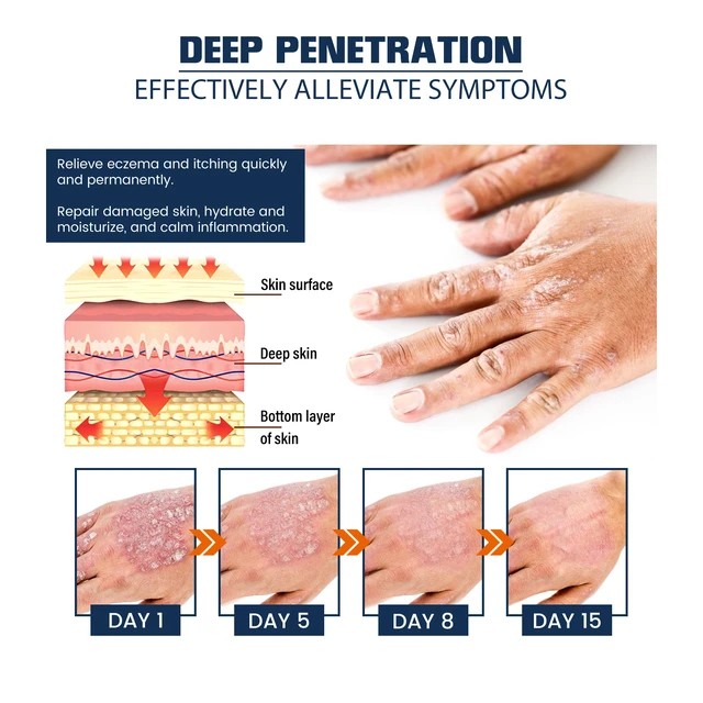 Alt view image 4 of 6 - Hydration & Soothing Spray for Calming Skin Care, Skincare Mist Intensive Nourishment
