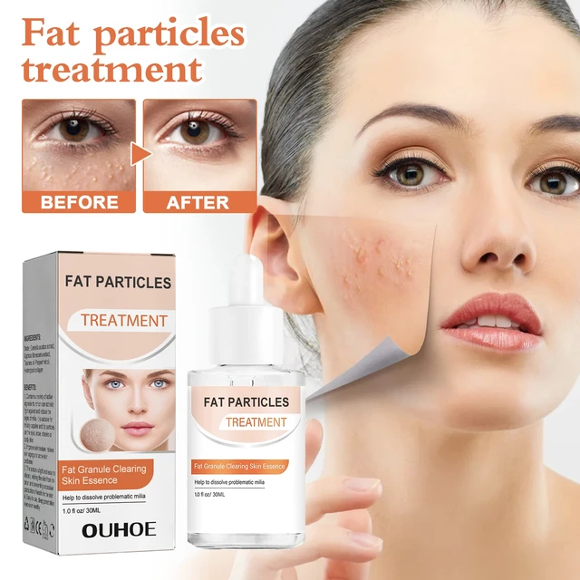 Alt view image 2 of 6 - Moisturizing & Pore Refining, Millet Care Essence for Acne Relief