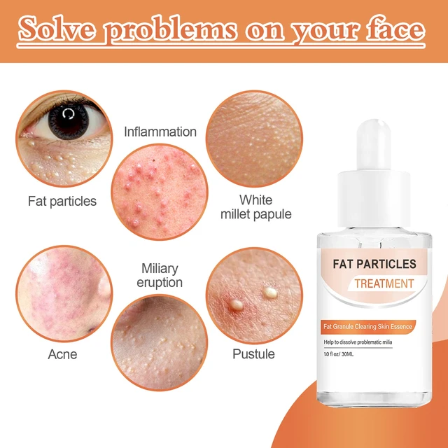 Alt view image 3 of 6 - Moisturizing & Pore Refining, Millet Care Essence for Acne Relief