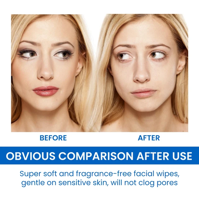 Alt view image 6 of 6 - Deep Clean Refreshing & Non-Irritating, Mild Cleansing Makeup Remover Wipes for Face & Eyes