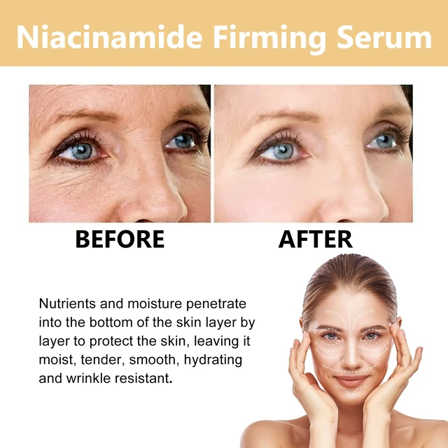 Alt view image 4 of 6 - Niacinamide Firming Serum Hydrating Skin Tightening & Radiance Booster for Dull Complexion