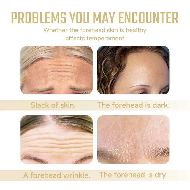 Alt view image 3 of 6 - and Reducing Fine Lines & Creases, Lifting, West Month Collagen Forehead Wrinkle Patches for Smoothing