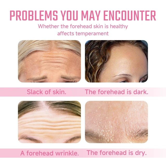 Alt view image 3 of 6 - and Reducing Forehead Lines, Tightening Skin, Moisturizing, Forehead Collagen Patches for Hydration