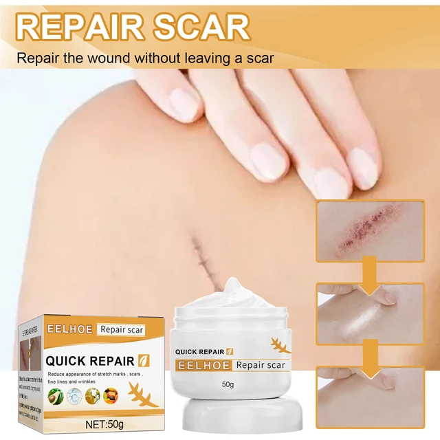 Alt view image 2 of 7 - Surgery & Wound Healing Repair Ointment, EELHOO Scar Removal Cream for Burns
