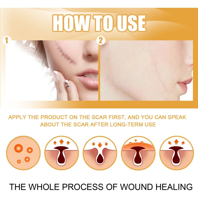 Alt view image 6 of 7 - Surgery & Wound Healing Repair Ointment, EELHOO Scar Removal Cream for Burns