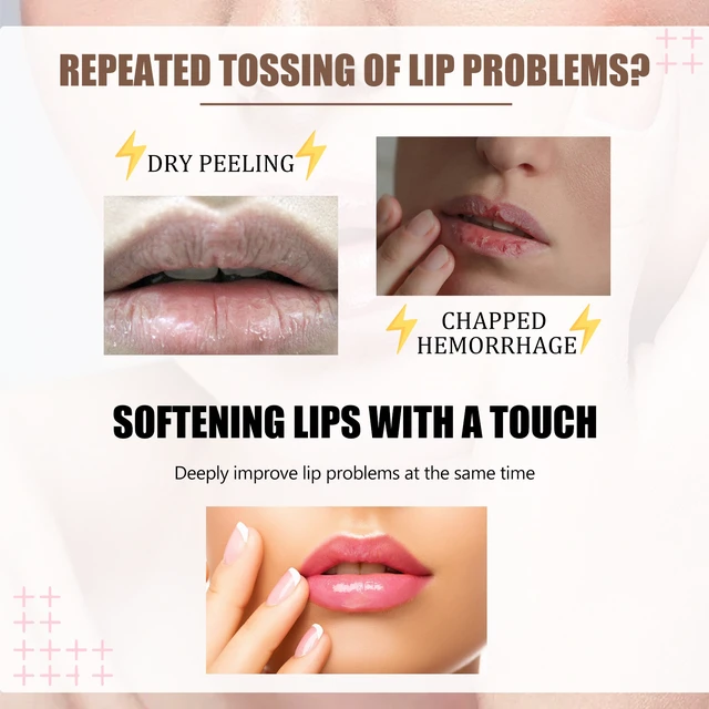Alt view image 3 of 7 - Moisturizing Lip Oil for Plumping and Hydration with Defined Lip Pattern