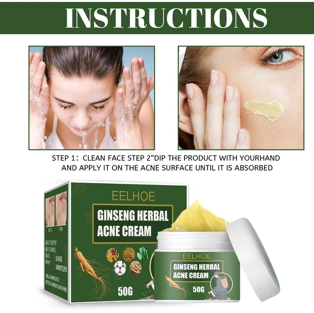 Alt view image 5 of 5 - Herbal Acne Care Cream Moisturizing Hydrating Cleanser Water-Oil Balance Fade Acne Marks