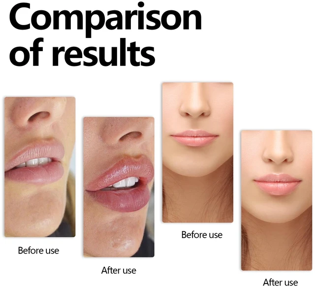 Alt view image 3 of 6 - Dewy Lips, Anti-Dryness & Plumping Serum for Soft, Hydrating Lip Essence - Moisturizing
