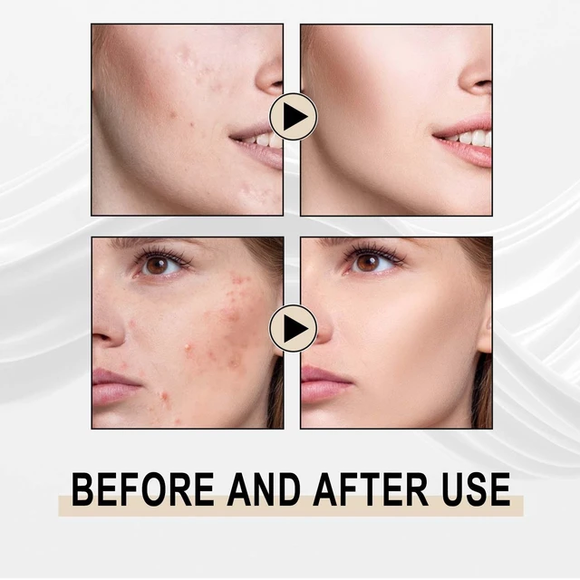 Main image of Exfoliation & Hydration, Blackhead Removal, Pore Minimization, Lactobionic Acid Essence for Deep Cleansing
