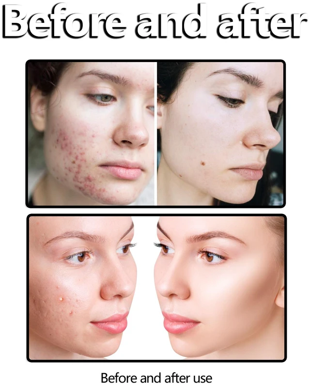 Alt view image 2 of 5 - Jasmine Face Wash Mild Deep Clean Daily Refreshing Soft Smooth Skin Care